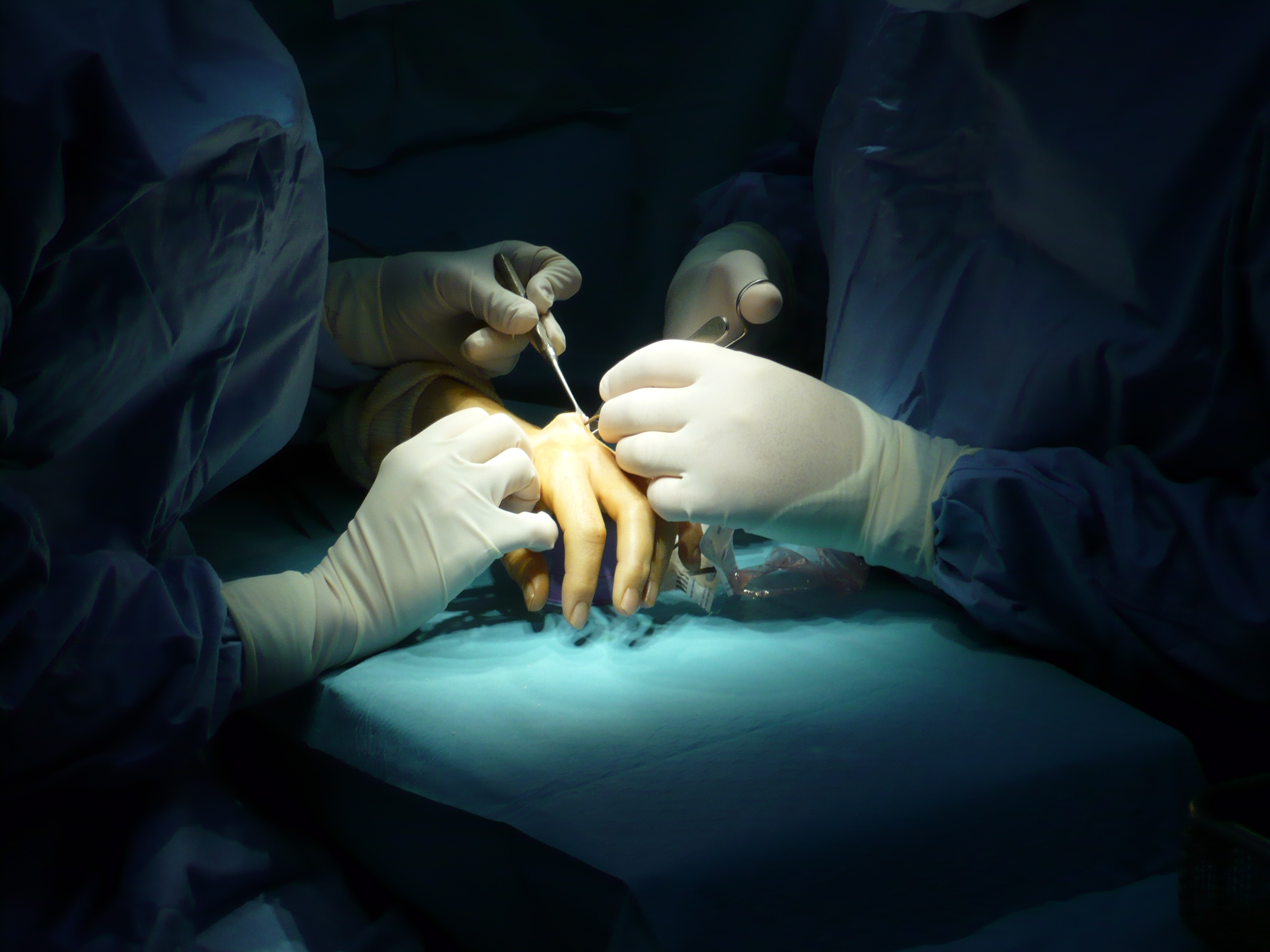Hand surgery.jpg