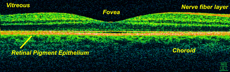 OCT image of the retina