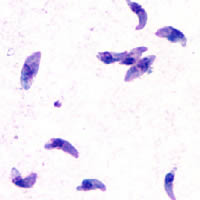 Toxoplasma gondii tachyzoites