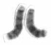 Chromosome 13