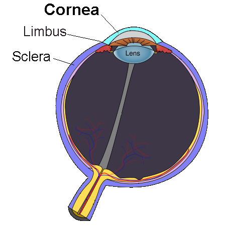 Corneal surface showing punctate epithelial erosions