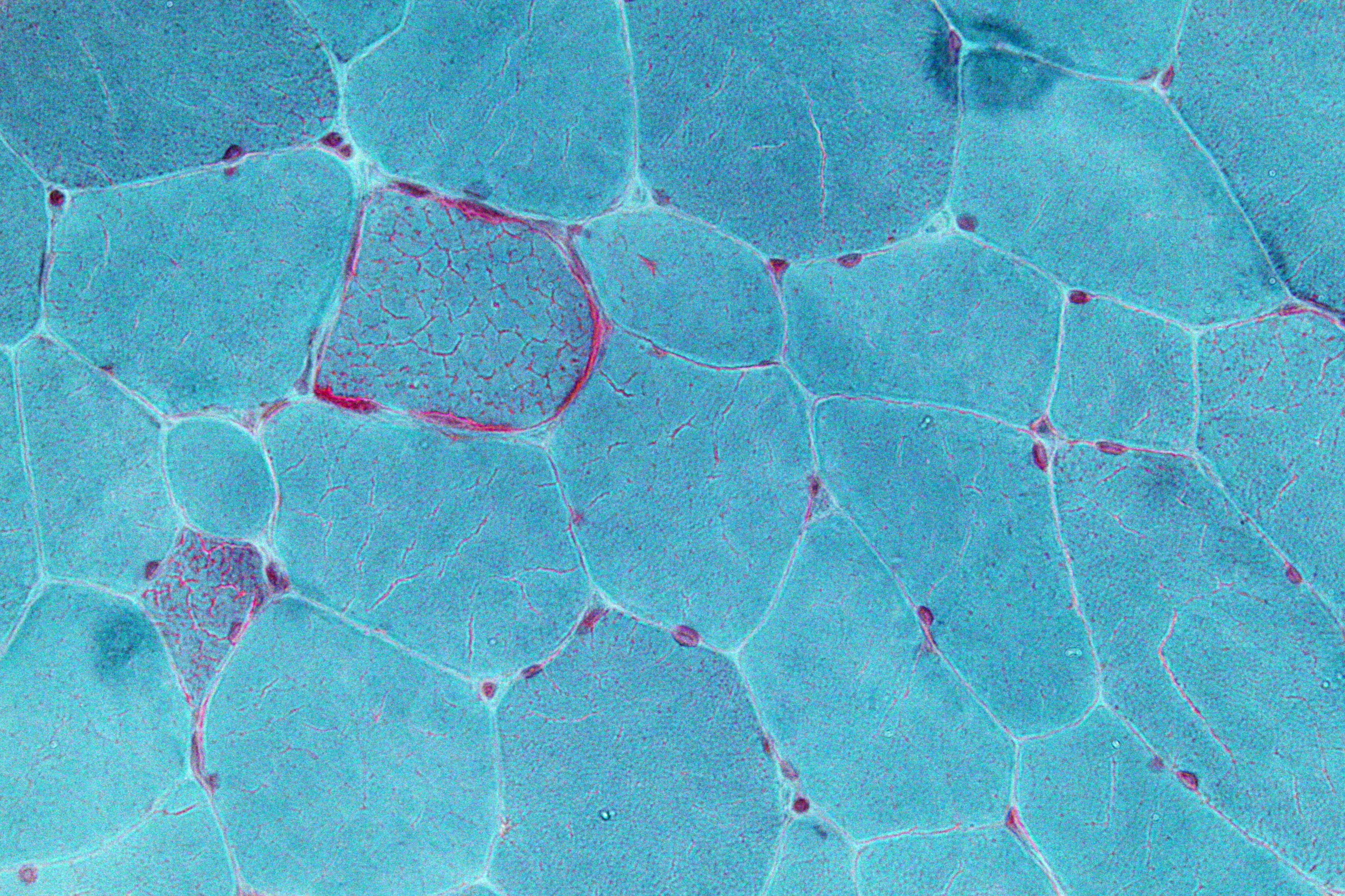 Ragged red fibers seen under a microscope
