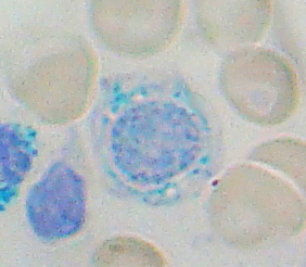 Sideroblast