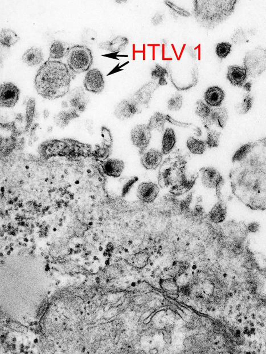 Electron micrograph of HTLV-1 virus