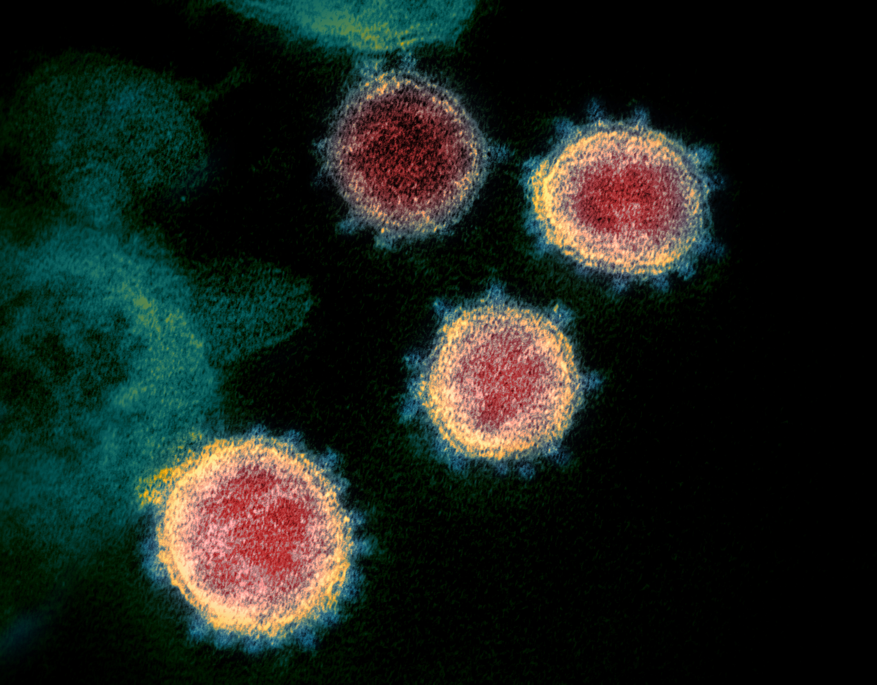 Image of SARS-CoV-2 virus