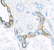 Keratin structure