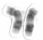 Chromosome 17