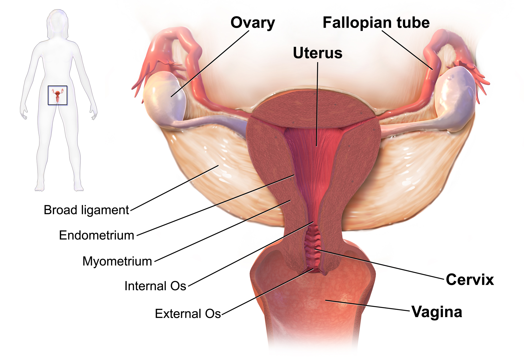 Diagram showing sites of pelvic inflammatory disease