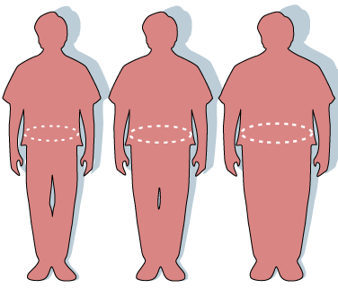 Obesity-waist circumference