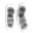 Chromosome 20