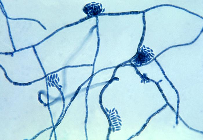 Hortaea werneckii fungus causes tinea nigra