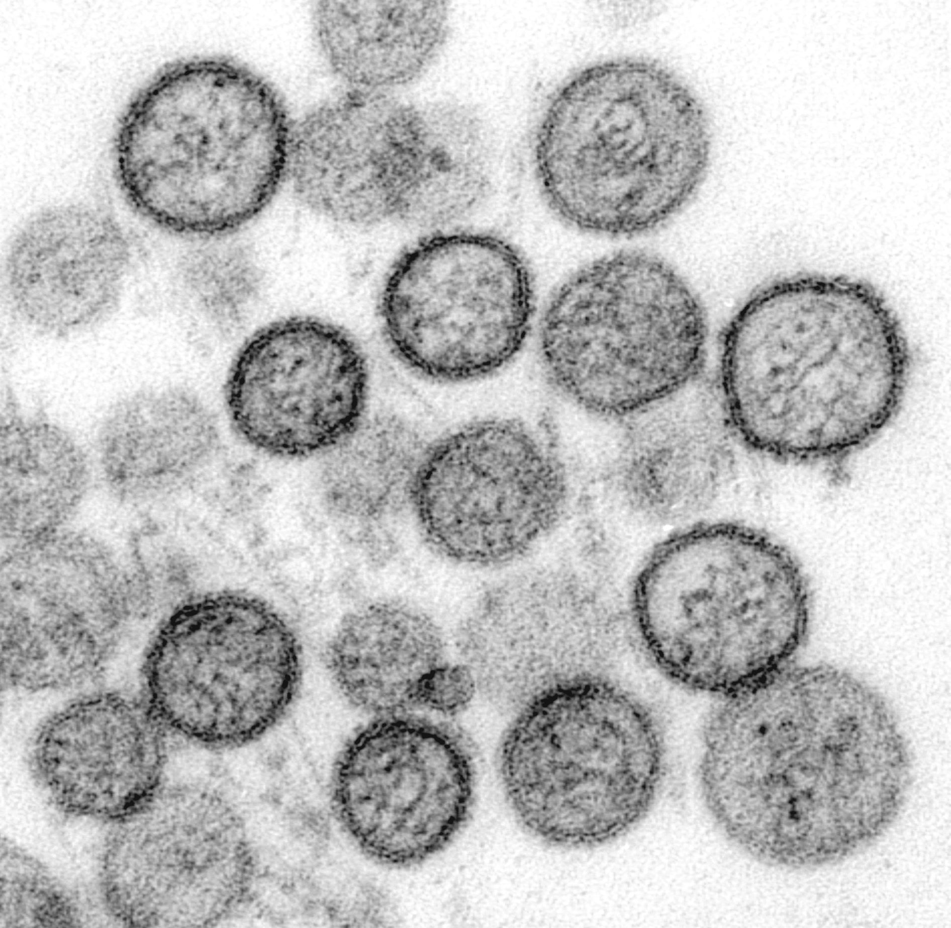 Electron micrograph of Sin Nombre virus