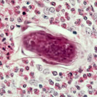 S mansoni egg