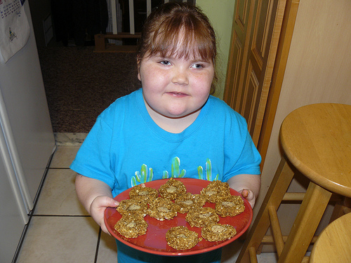 Image of a child with ROHHAD syndrome