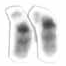 Chromosome 22