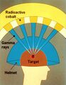 Gamma Knife Graphic