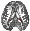 Corpora quadrigemina