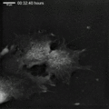 Human mesenchymal stem cells