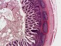 Peyer's patch in the ileum