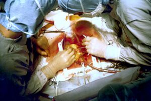 Caption:A cardiac surgeon performing a procedure.