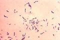 Corynebacterium striatum