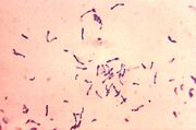 Corynebacterium diphtheriae Gram stain