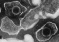 Epstein Barr Virus virions