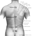 Iliac crest highlighted at center right.