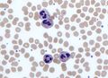 Immune system