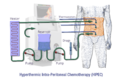 Hyperthermic intraperitoneal chemotherapy