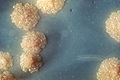 Tuberculosis culture
