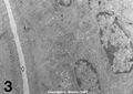 Electron micrograph of a nude mouse jejunum
