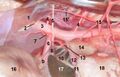 Celiac ganglion
