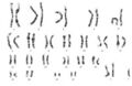 Klinefelter syndrome karyotype