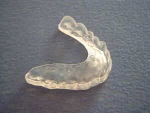 Occlusal guard
