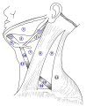 Carotid triangle illustration