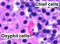 Annotated image of oxyphil and chief cells in parathyroid