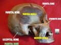 Lateral view of the parietal bone