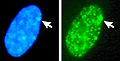 Barr body formation due to X-inactivation