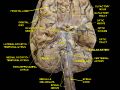 Fusiform gyrus