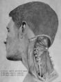 Suboccipital triangle dissection
