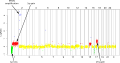 ACGH profile of the IMR32 neuroblastoma cell line