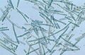 A bluegreen algae species Cylindrospermum sp under magnification