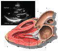Transthoracic echocardiogram