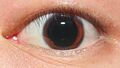Pupil