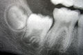 Molars in development