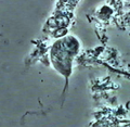 Trichomonas gingivalis