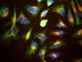 HeLa cells showing Lamp1 in red, vimentin in green, and DNA in blue