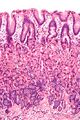 Normal gastric mucosa at intermediate magnification