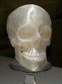 3D Printed Macrognathism